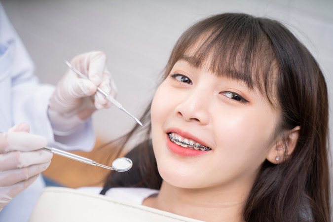 Pemasangan Behel Self-Ligating Metal Gigi Atas & Bawah + Cetak + Scaling di RRDC Dental Care