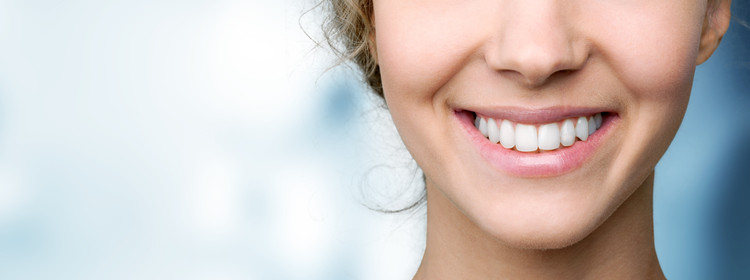 Home Bleaching Gigi di Mydentismile