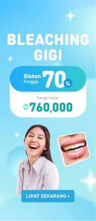 😁 Diskon Pemutihan Gigi Hingga 70%. Harga mulai dari Rp 760,000!