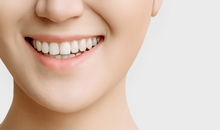Direct Veneer Super White di Global estetik