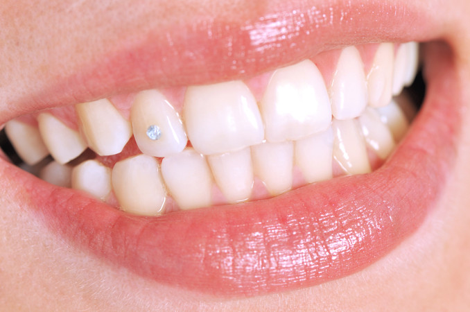 Bleaching Gigi dengan LED di Dontics Dental