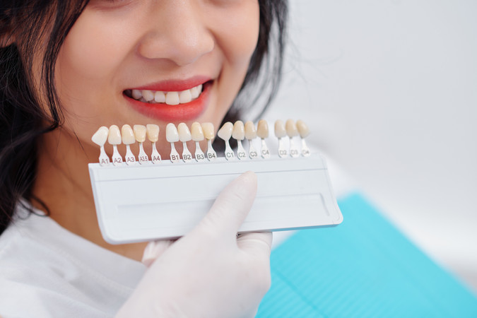 Bleaching Gigi dengan LED + Scaling Gigi di ARDE Dental Clinic