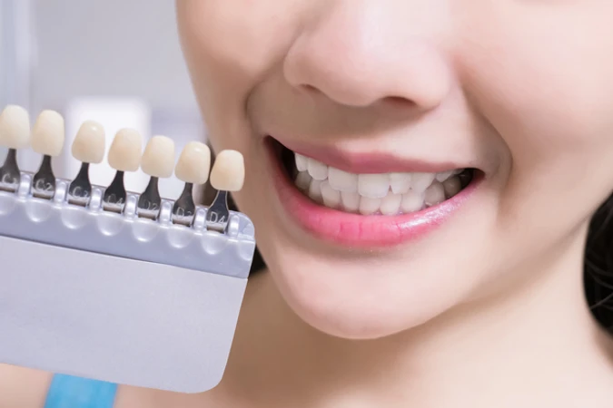 Varnish + Dental Brushing 1x di Klinik Gigi Dewi