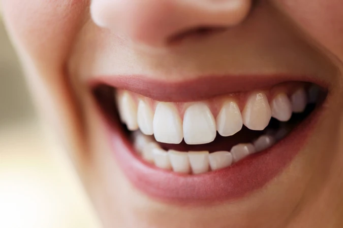 Bleaching Gigi dengan LED + Scaling Gigi + Stain Removal di Denta Beauty