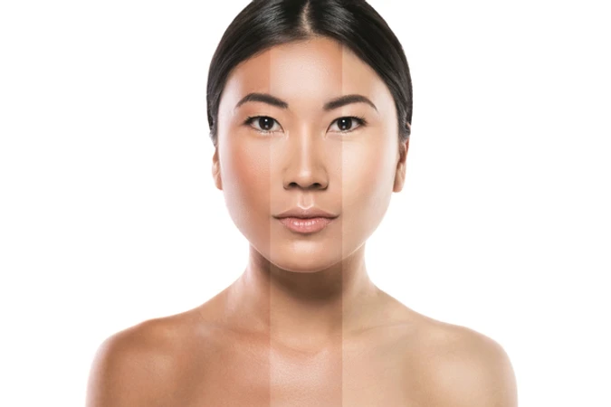 Infus Brightening Premium (Multivitamin dan Antioksidan) di Klinik Estetik Ambrosia