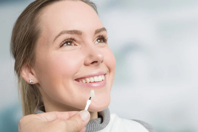 Indirect Veneer Zirconia di Klinik Gigi Senyum Ceria