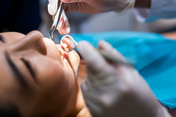 Scaling Gigi di PI Dental Care