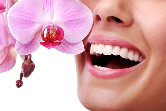 Direct Veneer Komposit di Mydentismile