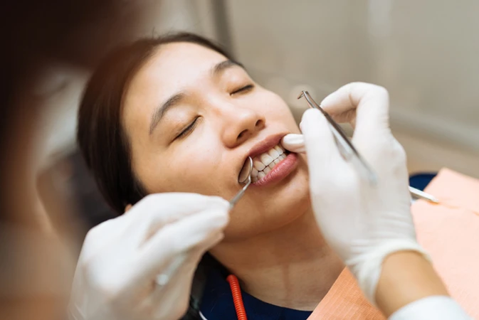 Pelepasan Behel + Scaling Gigi di FD Care