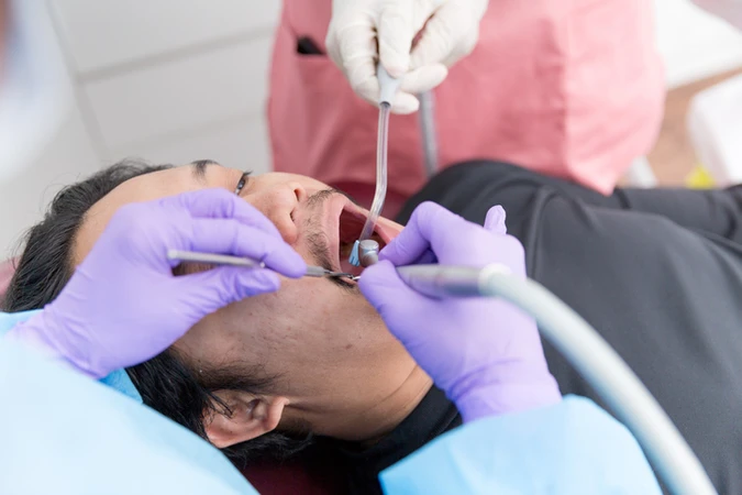 Tambal Gigi Belakang di Host Dental Clinic