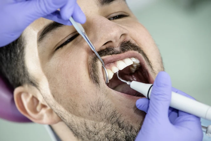 Scaling Gigi di Pearl Dental