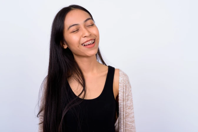 Pasang Behel Metal Buatan AS (AO) oleh drg. Umum + Cetak Gigi di Pixel Dental