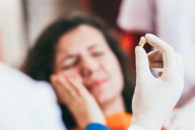 Cabut Gigi Bungsu oleh drg. Spesialis Bedah Mulut di Empire Dental Studio