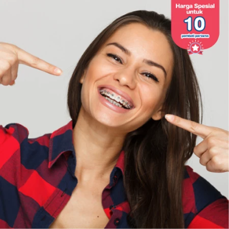 Pasang Behel Metal oleh drg. Spesialis Ortodontik di Akatara Clinic