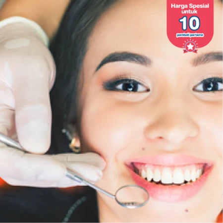 Paket Mouth Rehabilitation: Bleaching Gigi dengan LED + Dental Spa + Facial Lidah + Konsultasi di drg. Anggi Dental Clinic