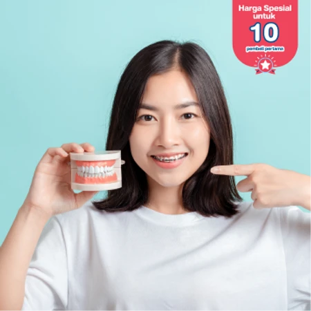 Pasang Behel Metal oleh drg. Spesialis Ortodontik di Klinik Gigi Dentalosophy