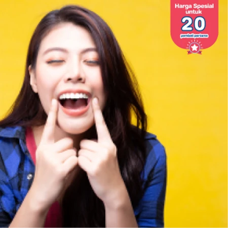 Bleaching Gigi dengan LED + Pemeriksaan dengan Kamera IntraOral di Champion Dental Care