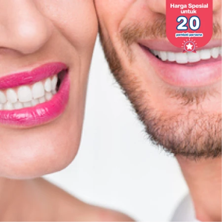 Paket Couple: Bleaching Gigi dengan LED + Scaling Gigi untuk 2 Orang di Fre Dental Care