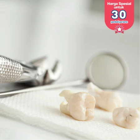 Cabut Gigi Bungsu (Odontektomi) + Konsultasi Di FD Care