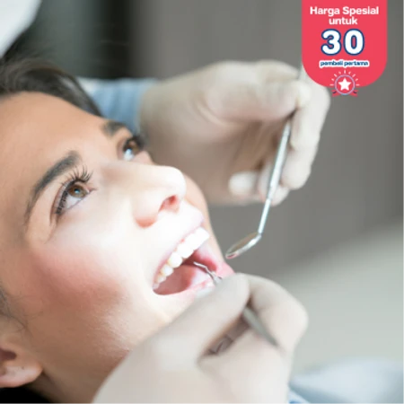 Lepas Behel + Scaling dan Polishing + Aplikasi Fluoride Topikal di Dentistique Clinic