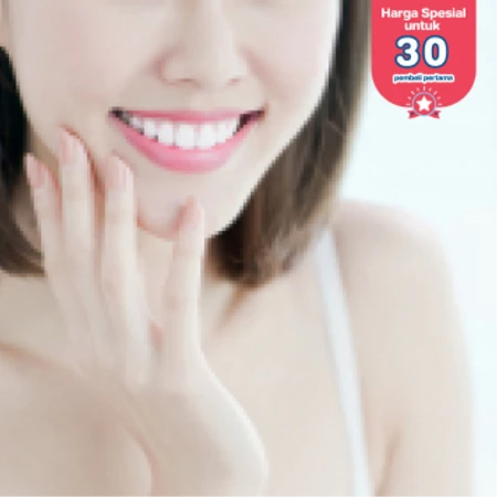 Bleaching Gigi dengan LED di Agsato Dental Clinic