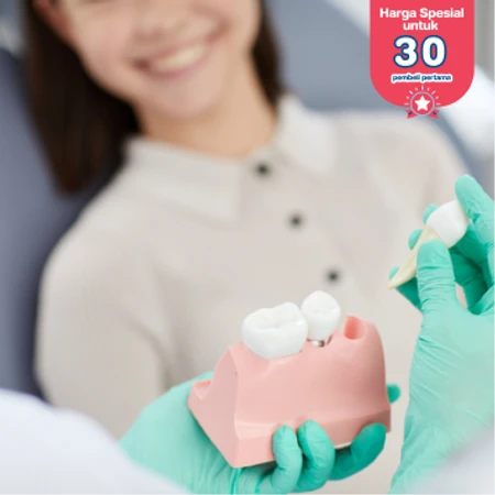 Cabut Gigi di Fre Dental