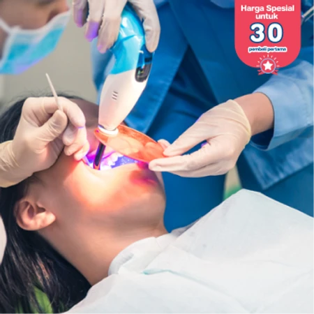 Tambal Gigi Belakang Bahan Resin Komposit di Dentistique Clinic