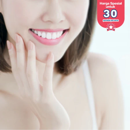 Bleaching Gigi dengan LED + Konsultasi di FD Care