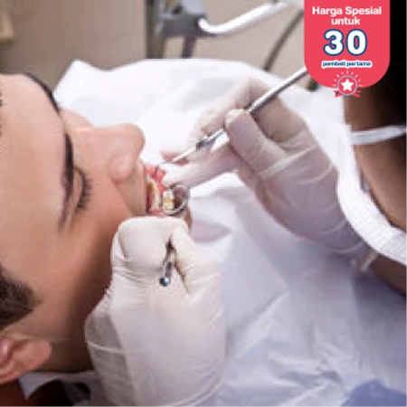 Scaling Gigi di di FD Care