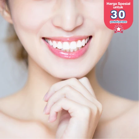 Bleaching Gigi dengan LED di MyDentiSmile