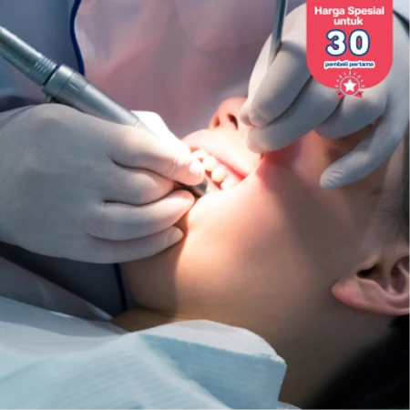 Tambal Gigi Non-Estetis Komposit atau Glass Ionomer Cement di Klinik Gigi Griya Denta