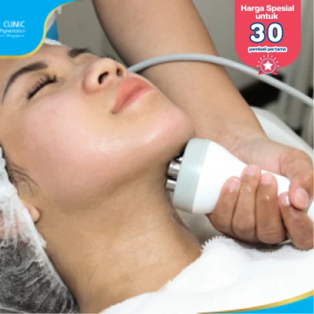 Double Chin Reduction dengan Radio Frequency (First Time Purchase) di Pure Laser Clinic