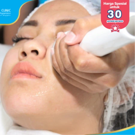 V-Shaped Face Contouring dengan Radio Frequency (First Time Purchase) di Pure Laser Clinic