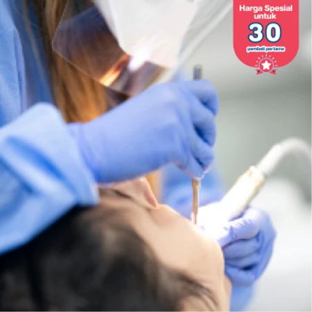 Tambal Gigi Estetis Gigi Belakang di Klinik Gigi Drg. Mia