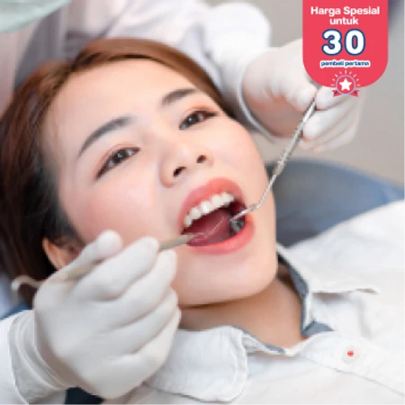 Lepas Behel + Scaling dan Polishing + aplikasi fluor 1x di Klinik Tooth Signature