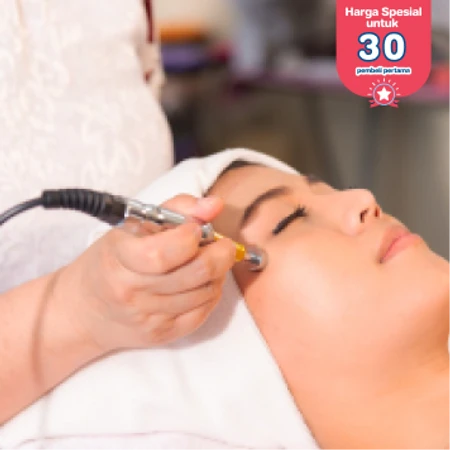 Photo Dynamic Therapy di D Elegance Clinic