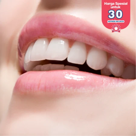 Pink Lip 1x di D Elegance Clinic