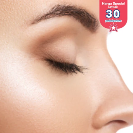 Dark Circle Eye di D Elegance Clinic