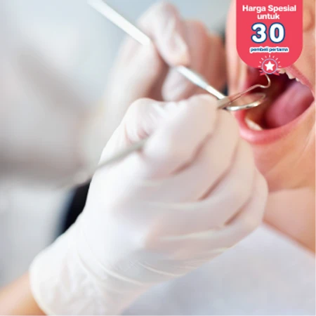 Scaling Gigi di Ocean Dental