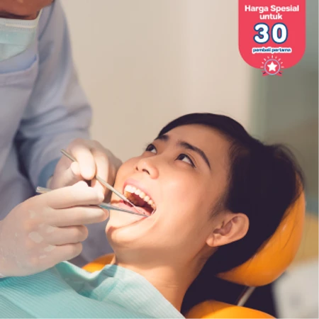 Cabut Gigi Bungsu (Odontektomi ) di Klinik Gigi drg Mia