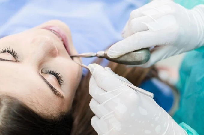 Perawatan Saluran Akar 1 Gigi Per Kunjungan di RRDC Dental Care