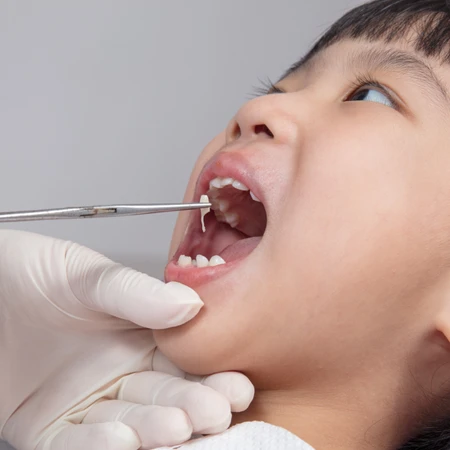 Cabut Gigi Susu di Abigael Maternity Clinic