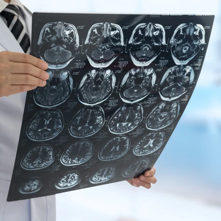 Paket Stroke Silver 1 Session di Physioku