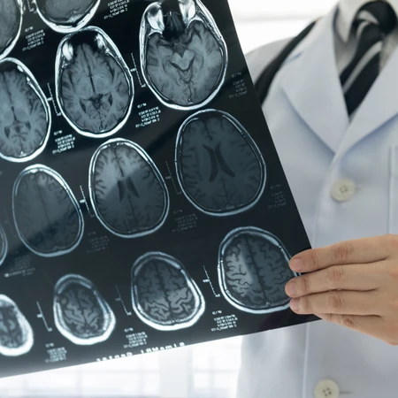 Paket Stroke Platinum 10 Session di Physioku