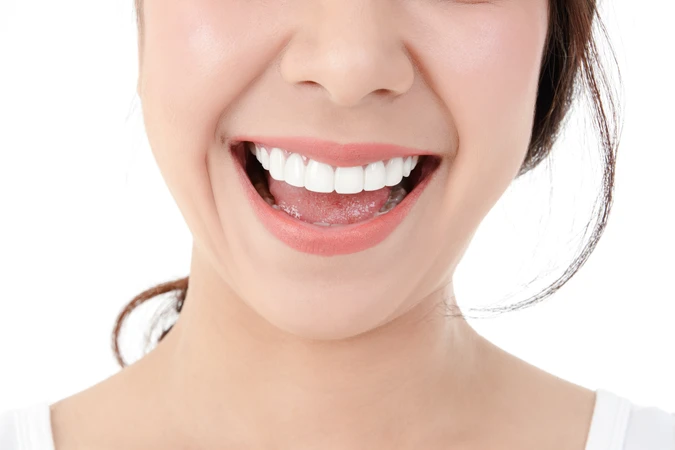 Indirect Veneer Porcelain 12 Gigi di DENTALMATE DENTALCARE