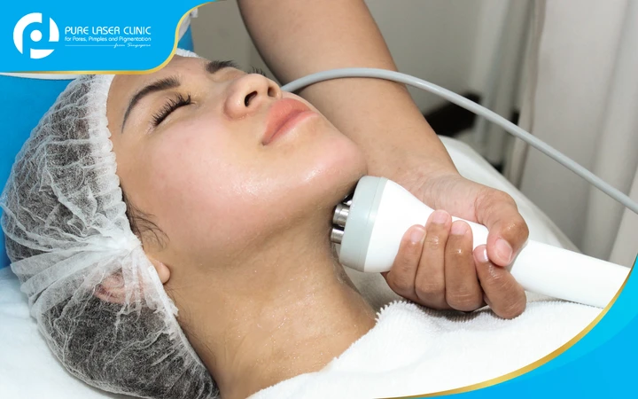 Double Chin Reduction dengan Radio Frequency di Pure Laser Clinic