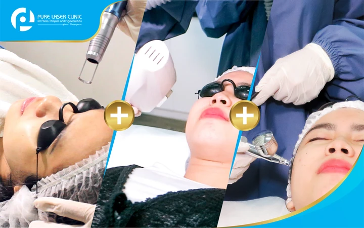 Photo Laser + Photo Shower + Rejuve Oxy Infusion (Paket New Customer) di Pure Laser Clinic