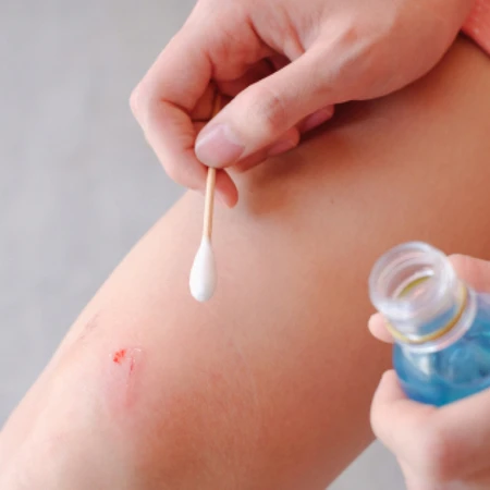 Pembersihan Luka di Max Medika