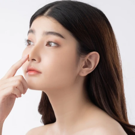 Threadlift Nose Per Benang di Light Skin Clinic