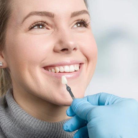 Indirect Veneer Zirconia di Klinik Gigi Cheer Up